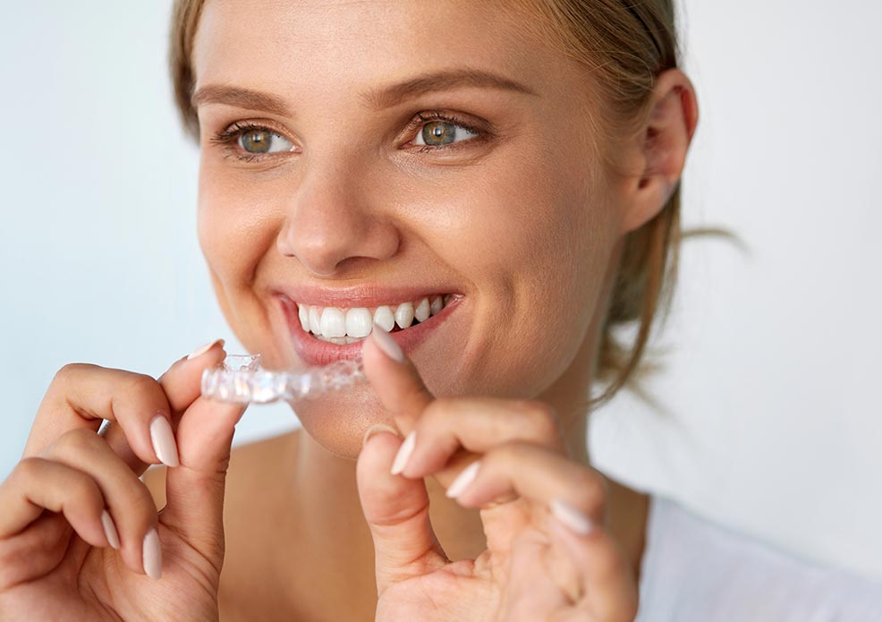 Transparente Zahnschienen